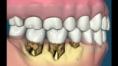 /album/fotogaleria-periodoncia/a1-png4/