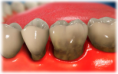 /album/fotogaleria-periodoncia/a3-png2/