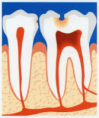 /album/fotogaleria-endodoncia/a1-png6/