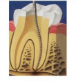 /album/fotogaleria-endodoncia/a4-png3/