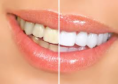 /album/fotogaleria-estetica/a1-png7/